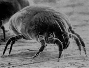 Scanning electron micrograph of an adult mite showing fine grooves and sensors.