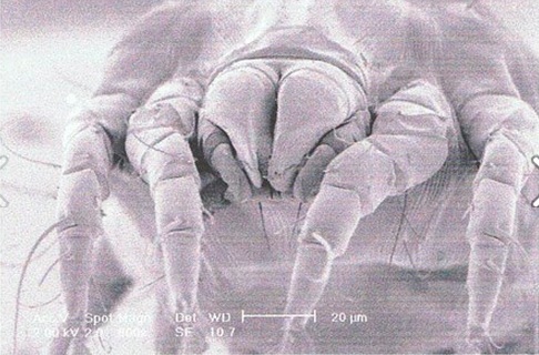 Close-up image of a house dust mite, Dermatophagoides pteronyssinus.