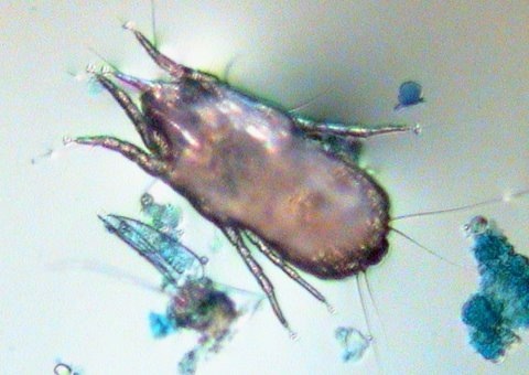 Microscopic photograph showing a house dust mite using its suckers and antennae for survival on a substrate.