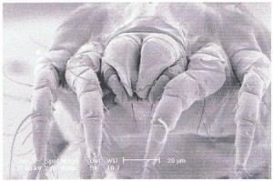 Front view of the house dust mite showing the mouth area and water channels.