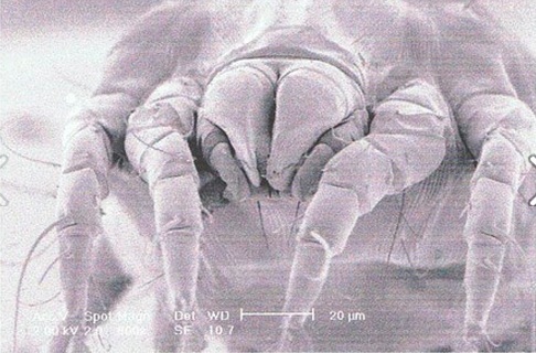 dust mite electron microscope